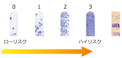 ミュータンスレンサ球菌